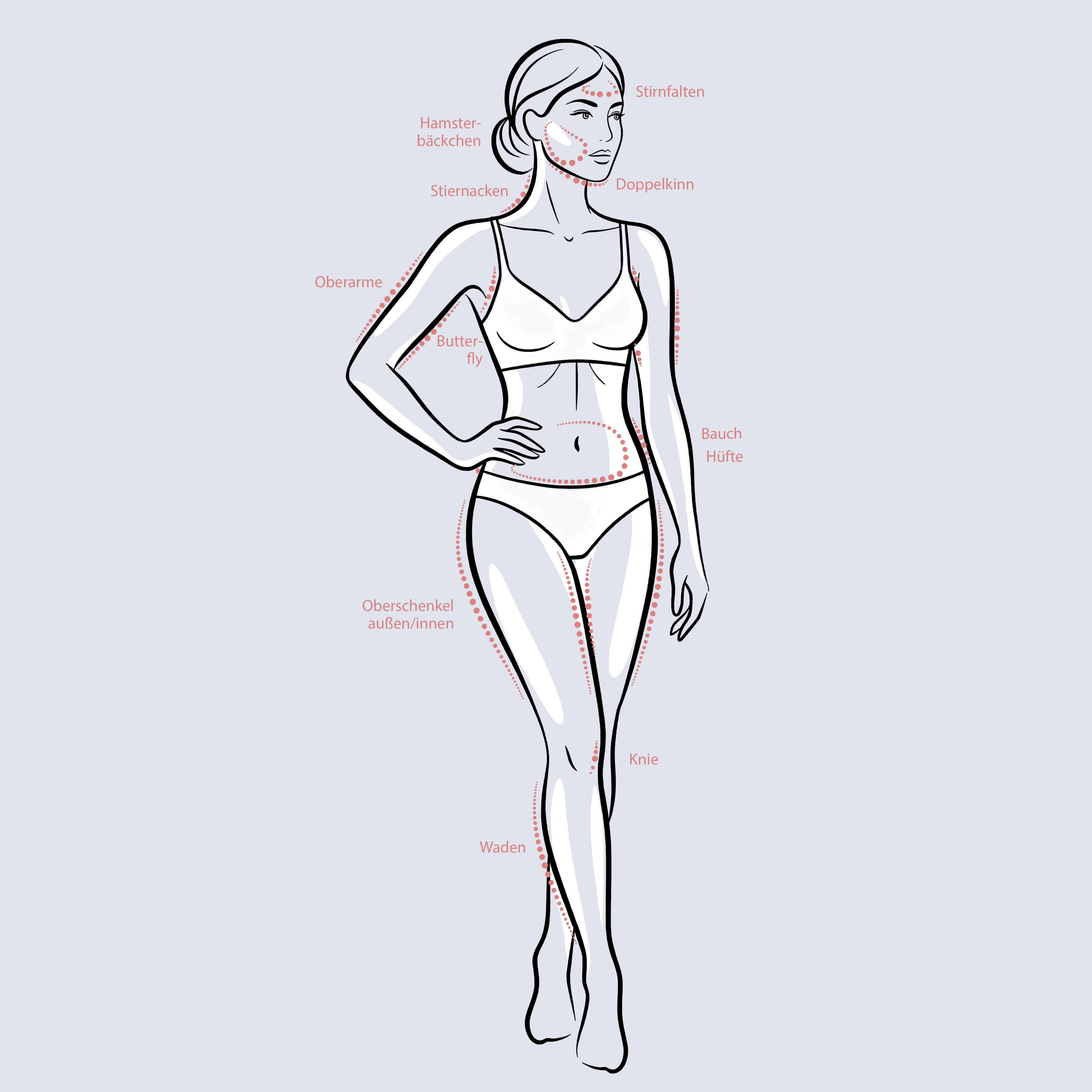 Behandlungsareale mit Michelangelo